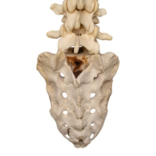 Spine and Sacrum - Loosely Strung

(30699) - Image 4
