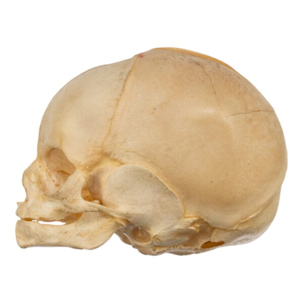 Fetal Skull

(35388) - Image 4