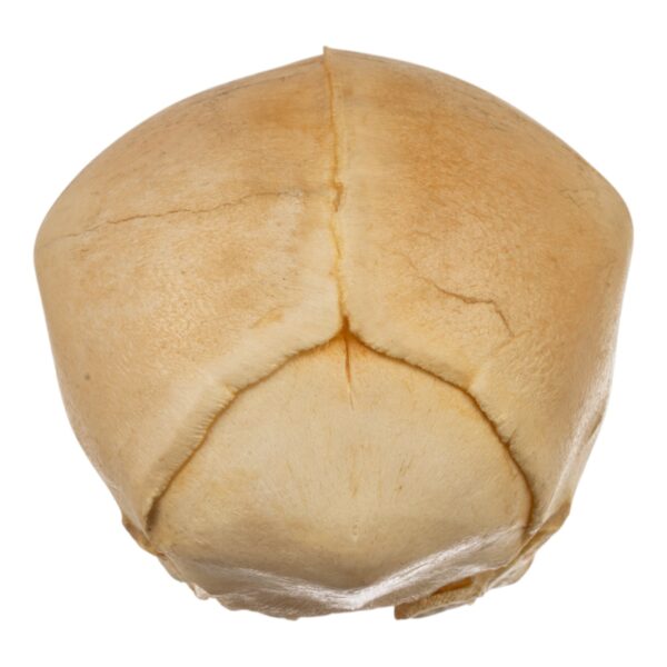Fetal Skull

(35388) - Image 2