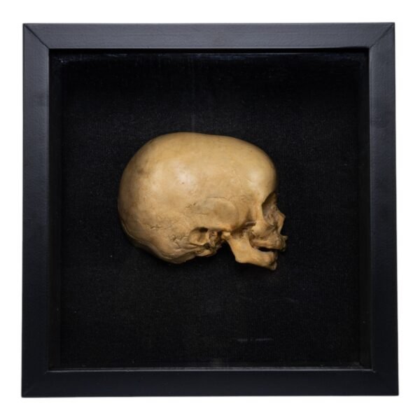 Infant Half Skull in Shadow Box
 (4005) - Image 3