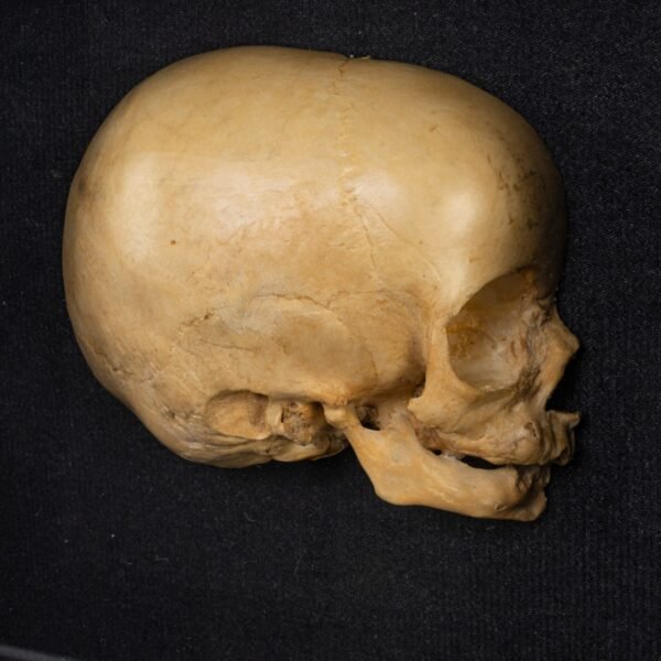 Infant Half Skull in Shadow Box
 (4005) - Image 2