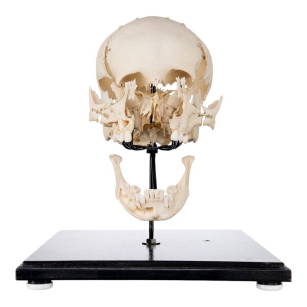 Exploded Skull on Stand

(50520) - Image 3