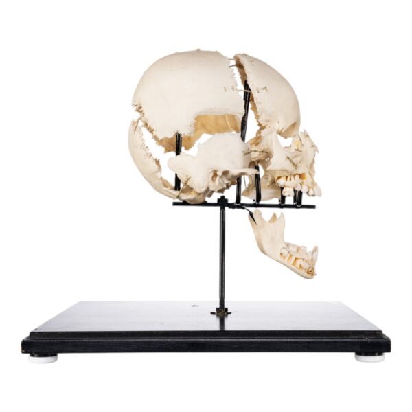 Exploded Skull on Stand

(50520) - Image 5