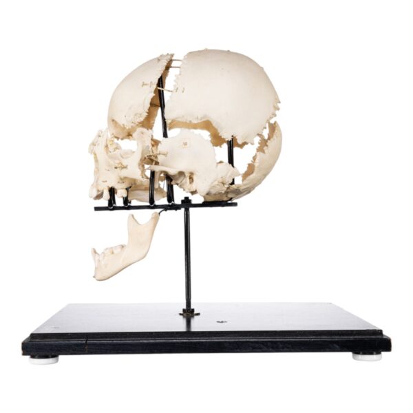 Exploded Skull on Stand

(50520) - Image 2