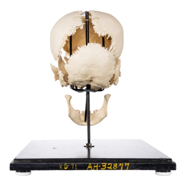 Exploded Skull on Stand

(50520) - Image 6