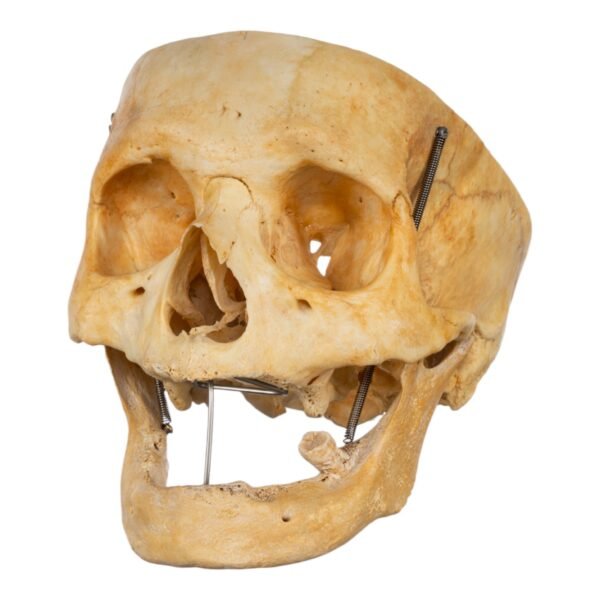 Skull - Partial

(30680) - Image 4