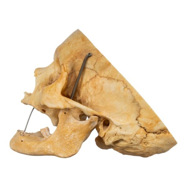 Skull - Partial

(30680)