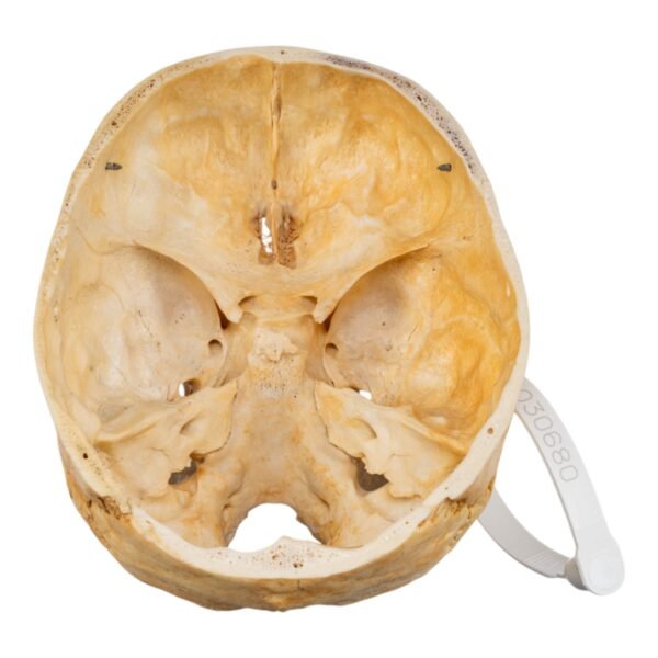 Skull - Partial

(30680) - Image 2