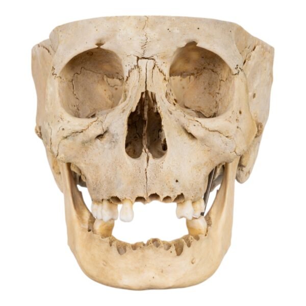 Skull - Partial

(30671) - Image 2