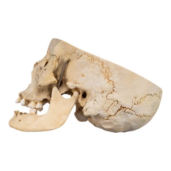 Skull - Partial

(30671) - Image 4