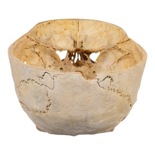 Skull - Partial

(30671) - Image 3