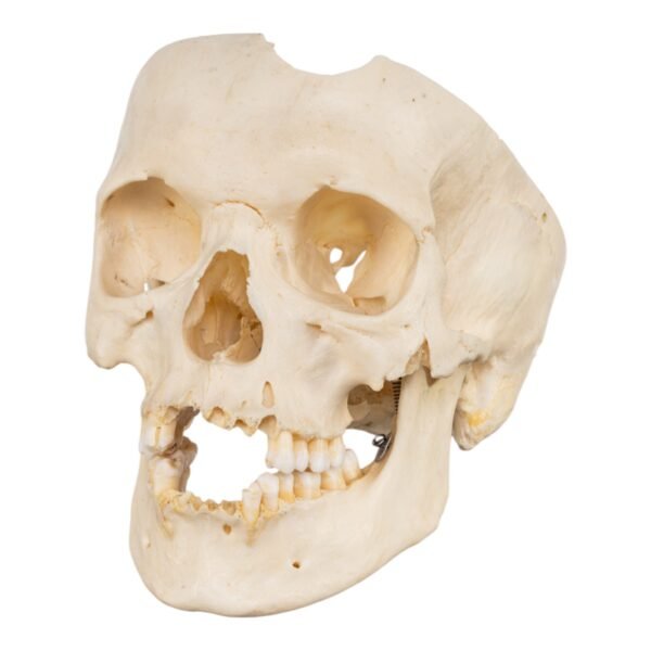 Skull - Partial

(30677) - Image 2