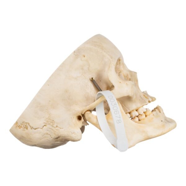 Skull - Partial

(30678) - Image 3