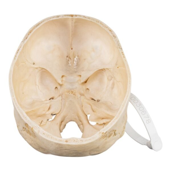 Skull - Partial

(30678) - Image 4