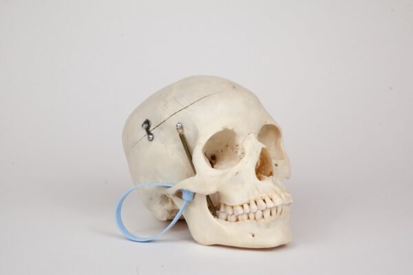 Medical Skull (0366) - Image 2