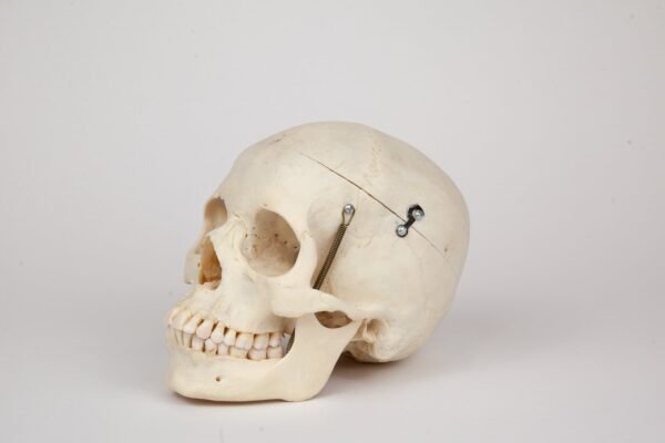 Medical Skull (0366) - Image 3