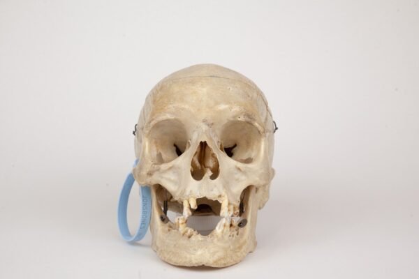 Medical Skull (0369)