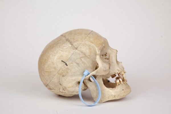 Medical Skull (0369) - Image 4