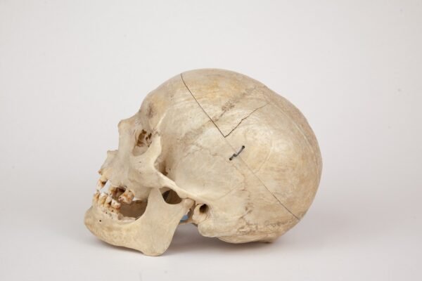 Medical Skull (0369) - Image 3
