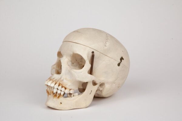 Medical Skull (0370) - Image 3