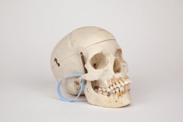 Medical Skull (0370) - Image 4