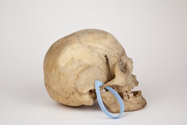 Uncut Medical Skull (0376) - Image 3