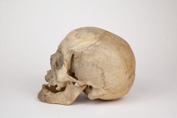 Uncut Medical Skull (0376) - Image 2