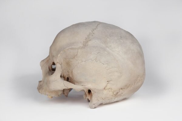 Uncut Medical Skull (0393) - Image 4