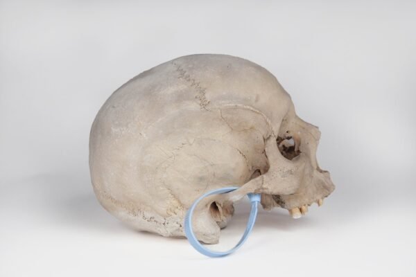 Uncut Medical Skull (0393) - Image 3