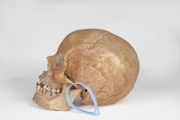 Uncut Medical Skull (0394) - Image 4