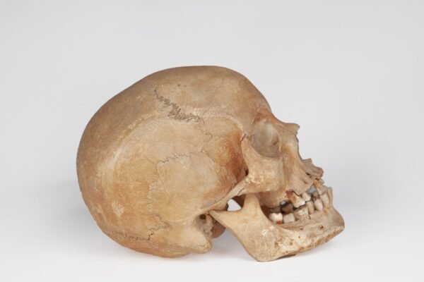 Uncut Medical Skull (0394) - Image 3