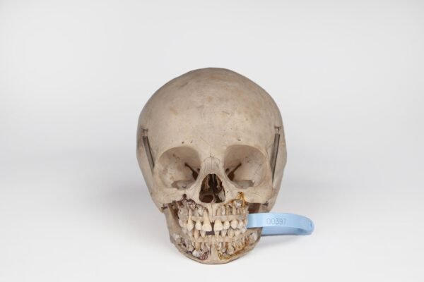 Uncut Pediatric Skull (0397)