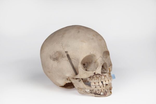 Uncut Pediatric Skull (0397) - Image 2