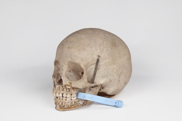 Uncut Pediatric Skull (0397) - Image 4