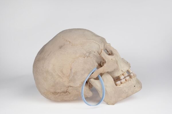 Uncut Medical Skull (0400) - Image 4