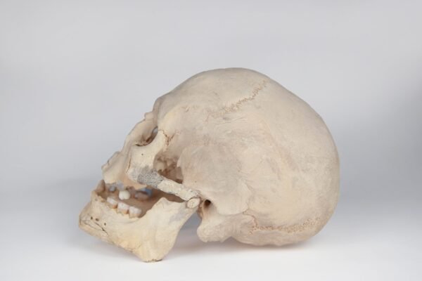 Uncut Medical Skull (0400) - Image 3