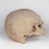Uncut Medical Skull (0403) - Image 4