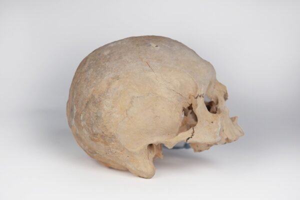 Uncut Medical Skull (0403) - Image 4