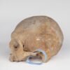 Uncut Medical Skull (0403) - Image 3