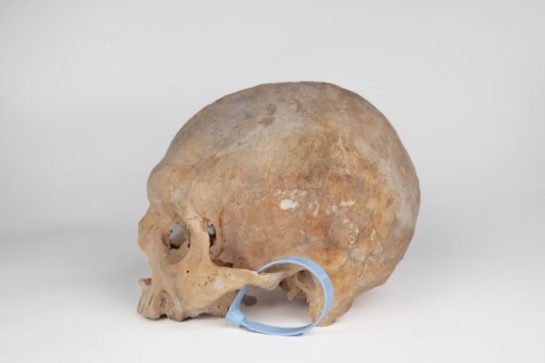 Uncut Medical Skull (0403) - Image 3