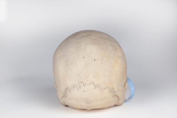 Uncut Medical Skull (0409) - Image 3