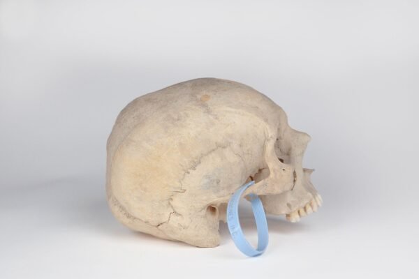 Uncut Medical Skull (0409) - Image 4