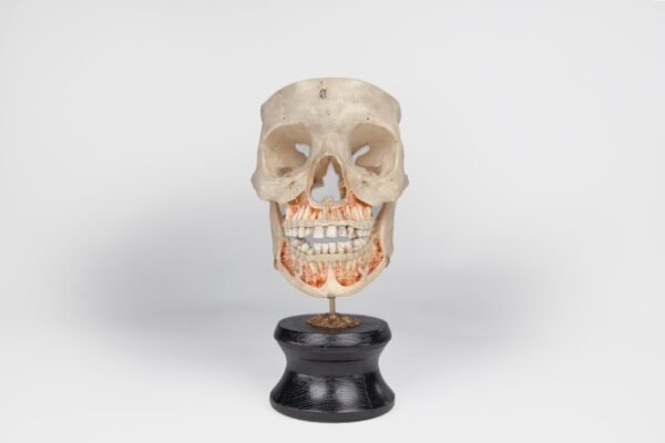 Viscerocranium Preparation 
(3342) - Image 2