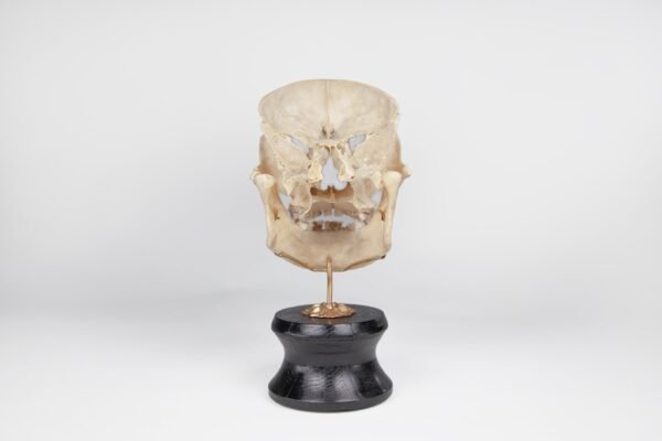 Viscerocranium Preparation 
(3342)
