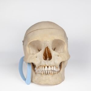 Medical Skull with Signs of Trauma (0381)