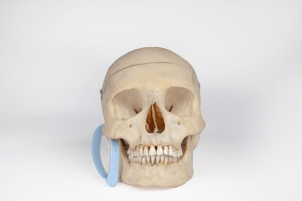 Medical Skull with Signs of Trauma (0381)