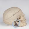 Medical Skull with Signs of Trauma (0381) - Image 3