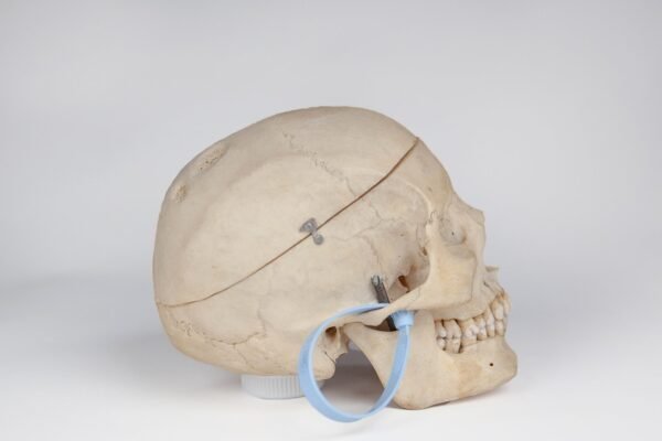 Medical Skull with Signs of Trauma (0381) - Image 3