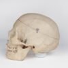 Medical Skull with Signs of Trauma (0381) - Image 2