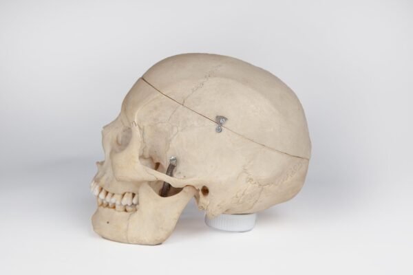 Medical Skull with Signs of Trauma (0381) - Image 2